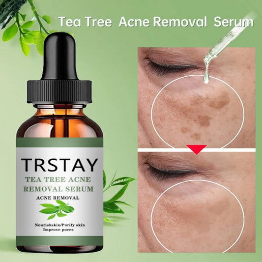 Lumara Acne Treatment Tea Tree Facial Serum